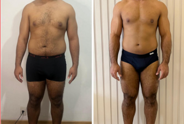 Antes e depois 1