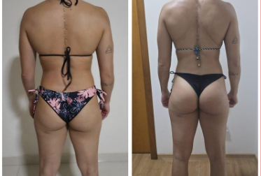 Antes e depois 2