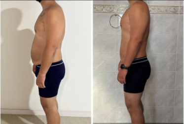 Antes e depois 3
