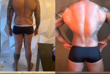 Antes e depois 4